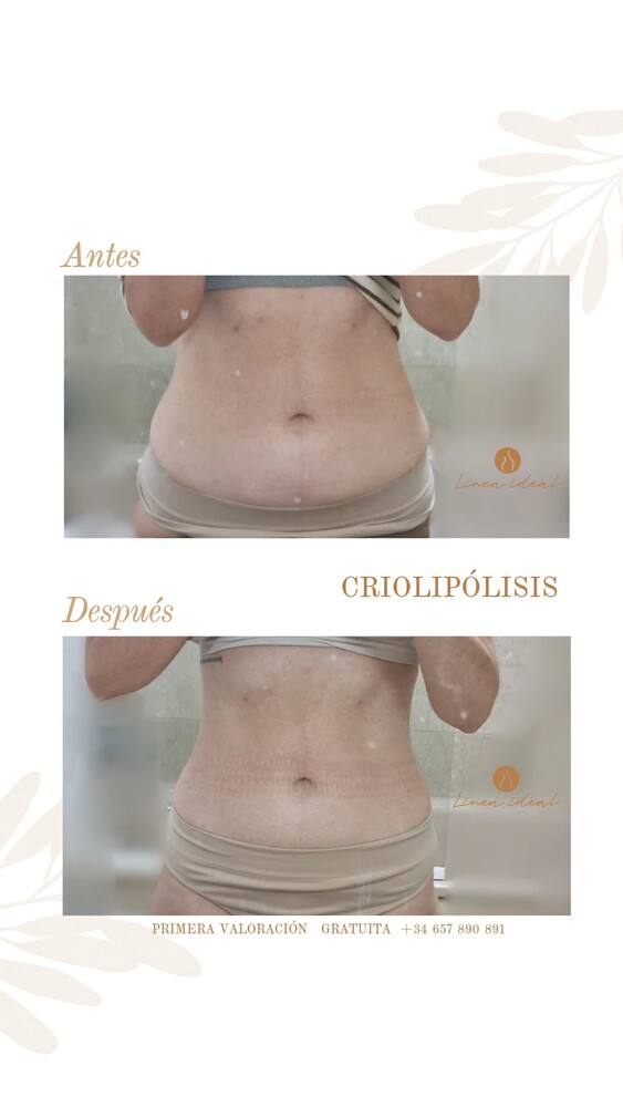 Before and After Result